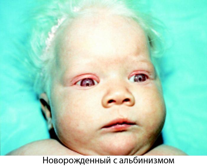 Во сколько у грудничков меняется цвет глаз или когда меняются глаза у новорожденных, секреты изменения цвета глаз у младенца stomatvrn.ru