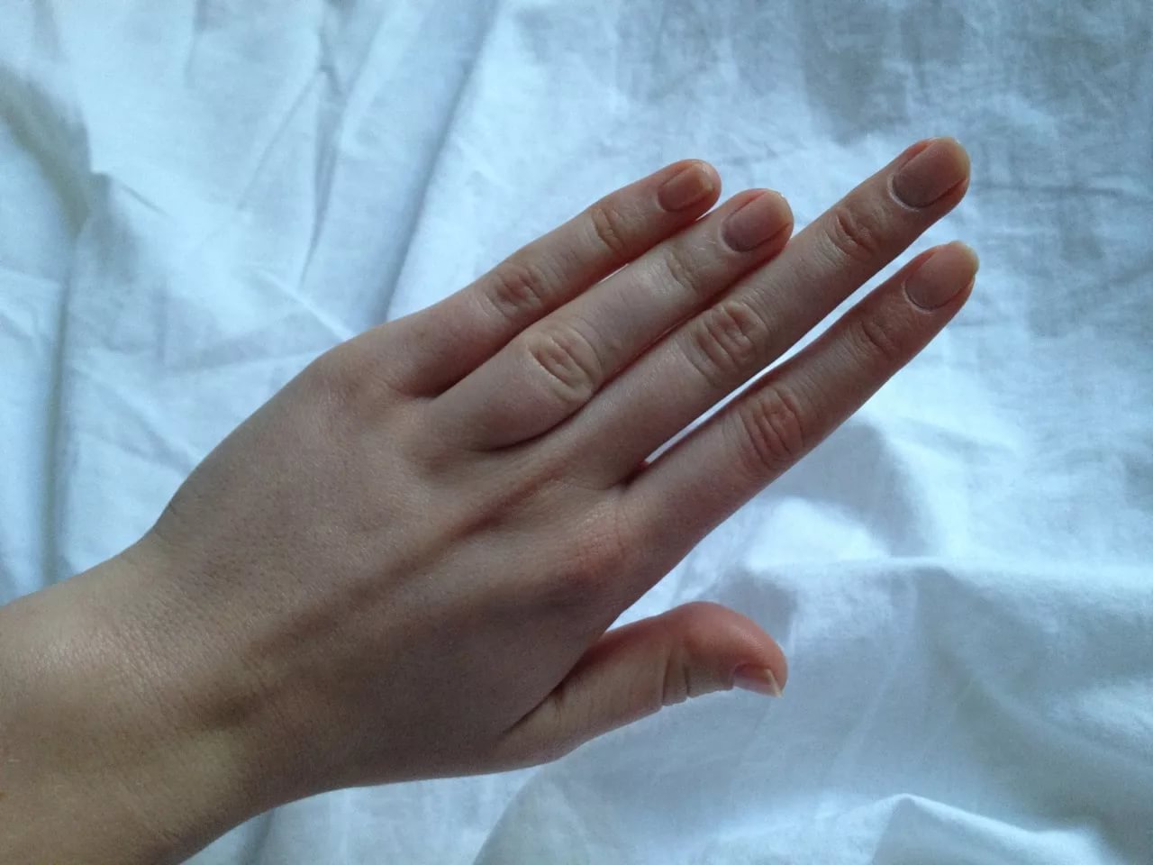 Пальцы становятся толще. Брахидактилия мизинцев. Длинные пальцы. Женские руки с длинными пальцами.