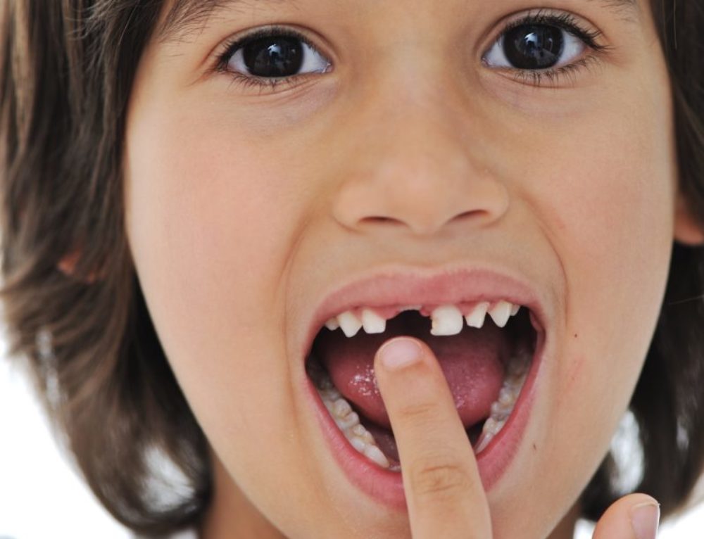 Врачебный ответ на вопрос родителей: «когда выпадают молочные зубы у детей?»