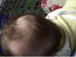 Плохо растут волосы у ребенка 5 лет причины и лечение
