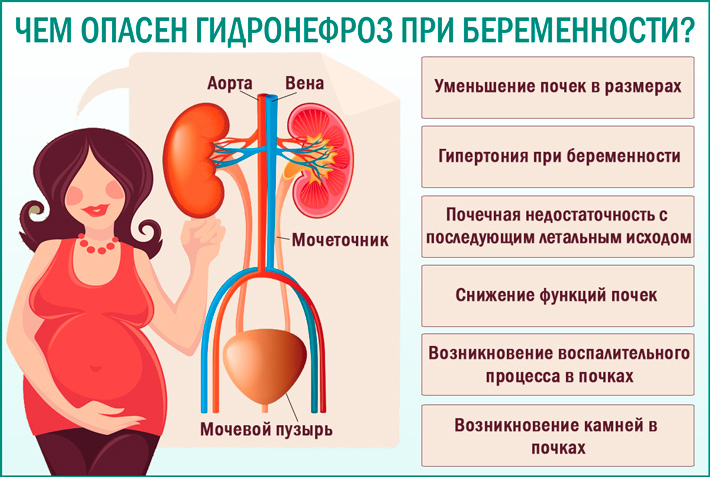 Процессы во время беременности. Заболевания почек у беременных. Почки при беременности. Пиелонефрит и беременность. Изменения почек при беременности.