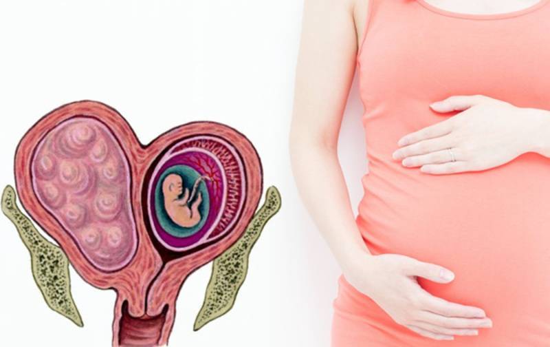 Детская матка у женщины: можно ли забеременеть и родить с такой патологией?