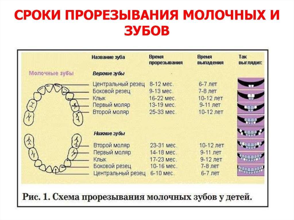 Порядок прорезывания зубов у детей: схема, симптомы, последовательность, сроки, фото