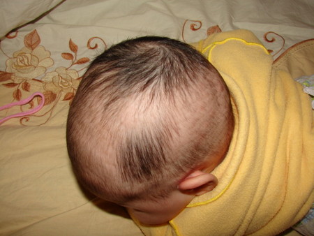 У ребенка в 1-2 года плохо растут волосы: причины,  методы лечения, советы врачей