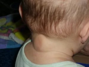Почему грудной ребенок чешет уши