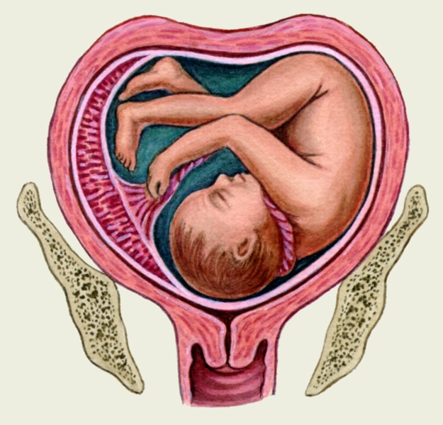 Матка седловидной формы: причины, как забеременеть, позы для зачатия, последствия