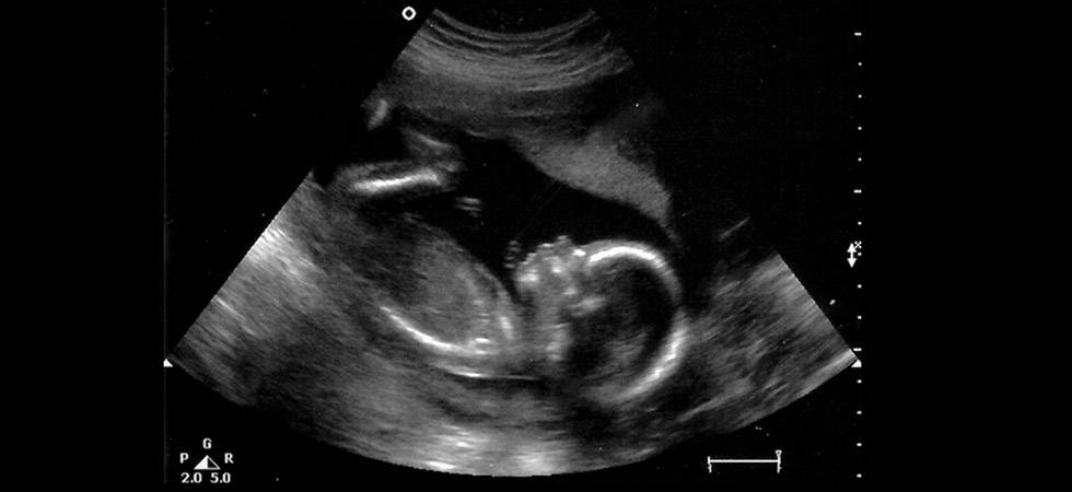19 неделя беременности: что происходит на этом сроке? размер плода и его развитие :: syl.ru