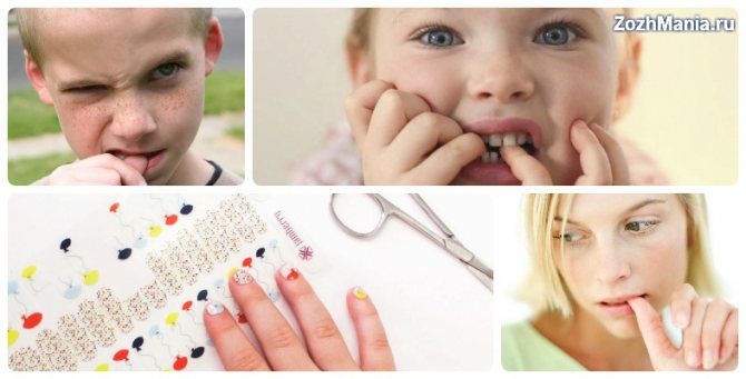 Как отучить ребенка грызть ногти: советы родителям