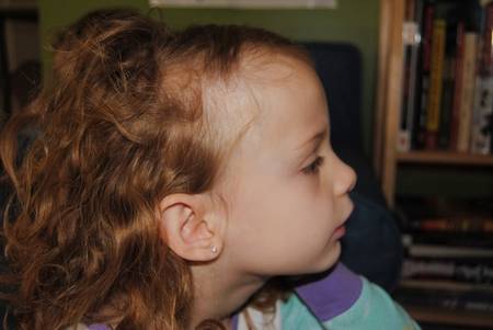 Комаровский - у ребенка выпадают волосы: что делать, у детей до года