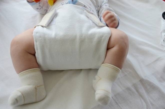 Дисплазия тазобедренных суставов у новорожденных, признаки у грудничков