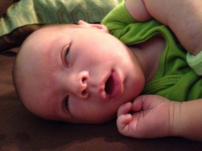 Почему грудничок может спать с открытыми глазами, диагностика и методы лечения