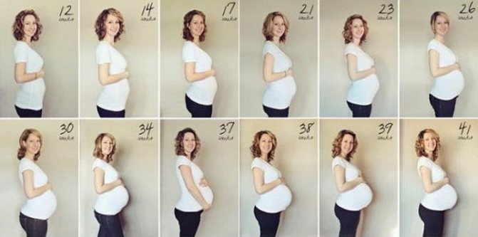 Живот на 18 неделе беременности у полных женщин фото