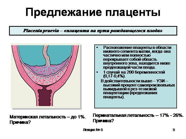 Полное предлежание плаценты: что это такое, чем грозит при беременности, хориона, полное центральное расположение