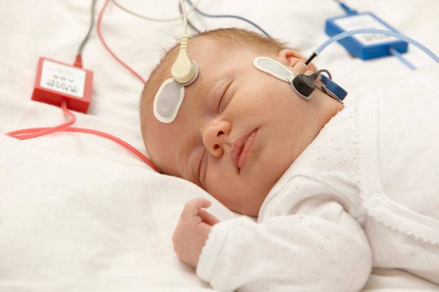 Аудиологический скрининг новорожденных: как проводится, фото, расшифровка результатов