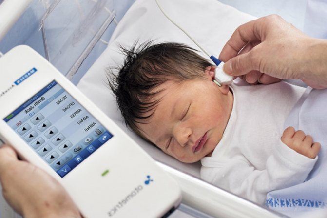 Как проводится аудиоскрининг новорожденных и какими должны быть результаты?