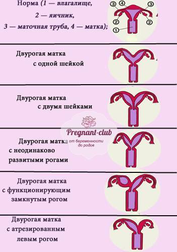 Седловидная матка : что это значит, влияние на беременность, узи признаки, роды | компетентно о здоровье на ilive