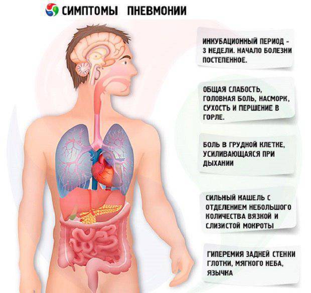 Пневмония при беременности | компетентно о здоровье на ilive