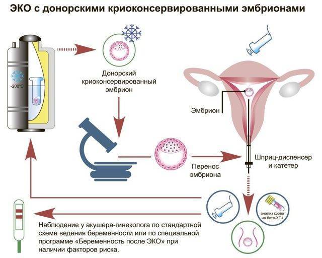 Метипред перед переносом эмбрионов