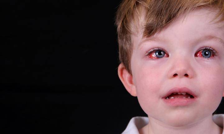 Ребёнок часто моргает глазами и жмурится: причины
