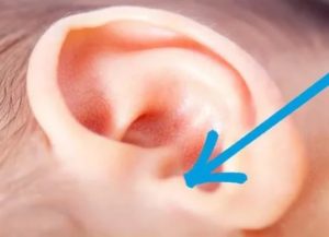 Как понять, что у грудничка болит ухо: симптомы и лечение